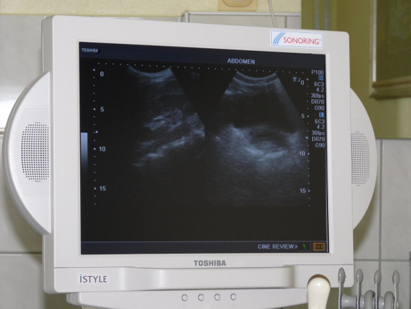 Bild zum Beitrag IGeL-Monitor: Ultraschalluntersuchung der Eierstöcke sinnvoll?